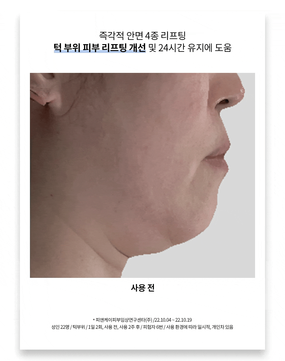 miracle cream_17